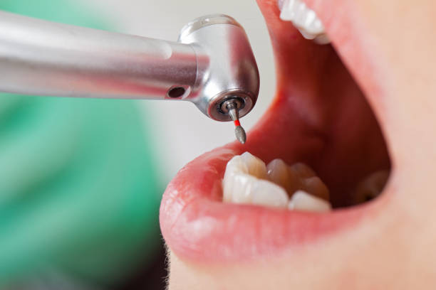 Professional Emergency Dental Service in TN